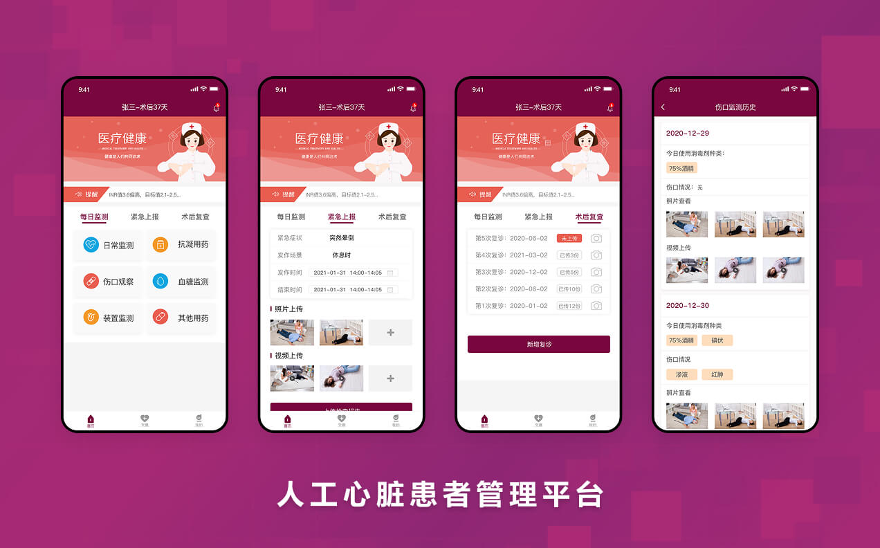 人工心脏患者管理平台